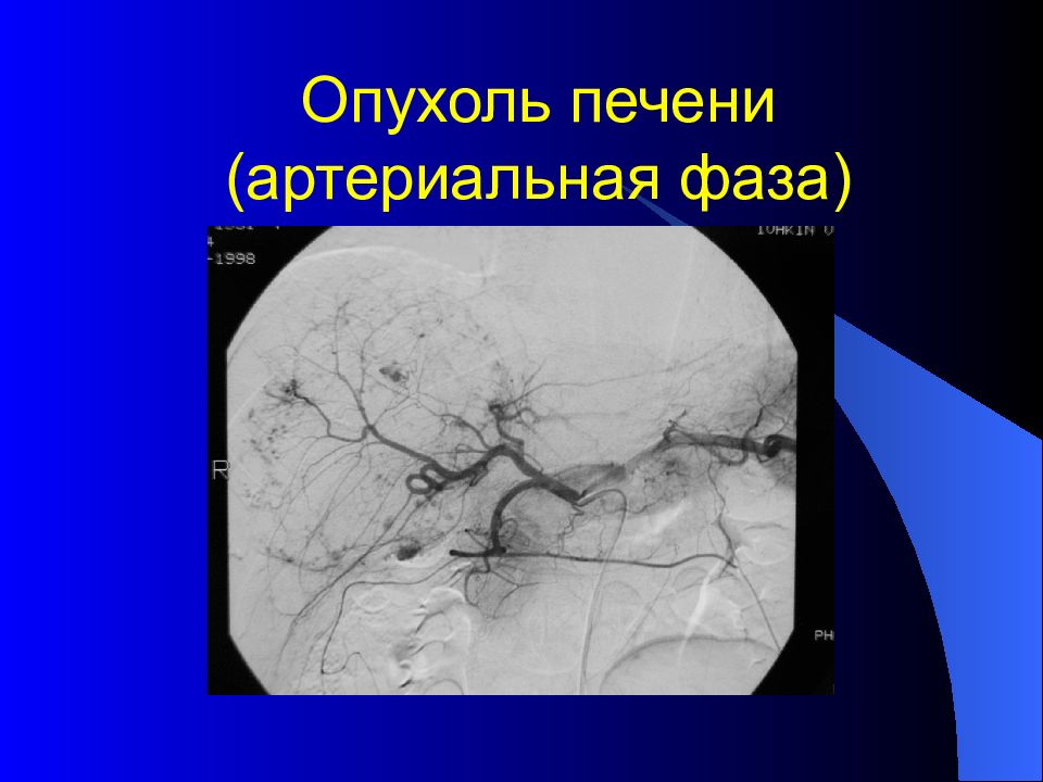 Лучевая диагностика брюшной полости презентация