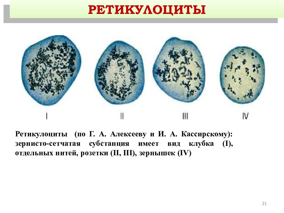 Ретикулоциты это. Зернисто-сетчатая субстанция ретикулоцитов – это. Стадия развития ретикулоцитов. Ретикулоциты. Ретикулоциты в норме на предметном стекле.