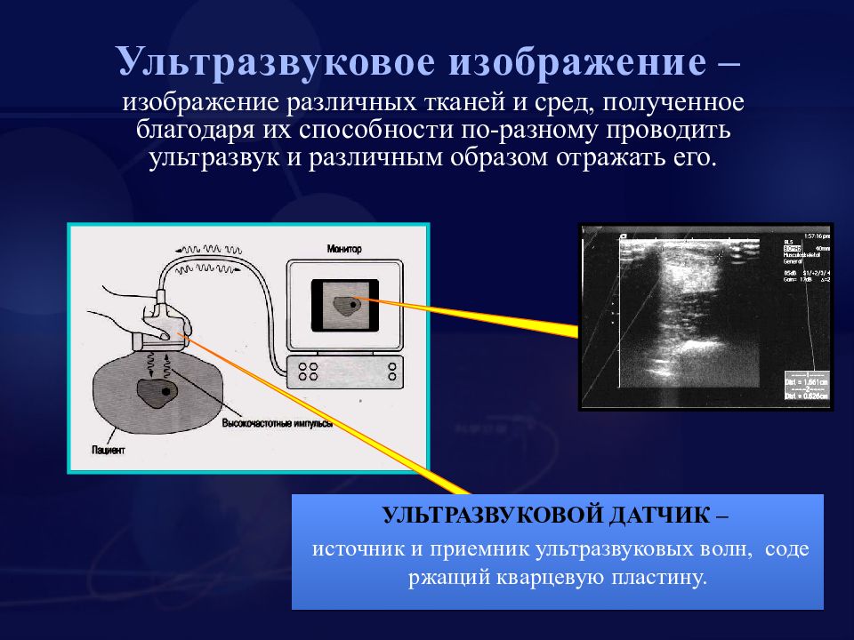 Принципы формирования уз изображения