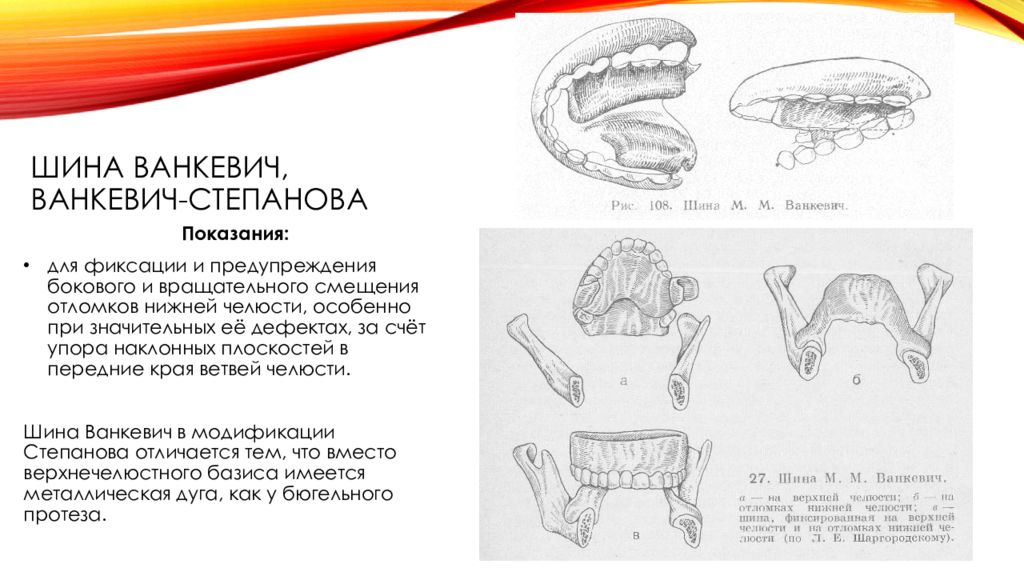 Шина Ванкевич — Сirca.su