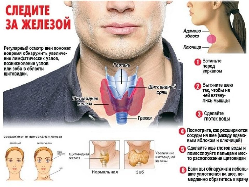 Щитовидная железа симптомы у мужчин внешние признаки. Щитовидная щитовидная железа. Проверил щитовмдную железа. Как проверить щитовидную железу.