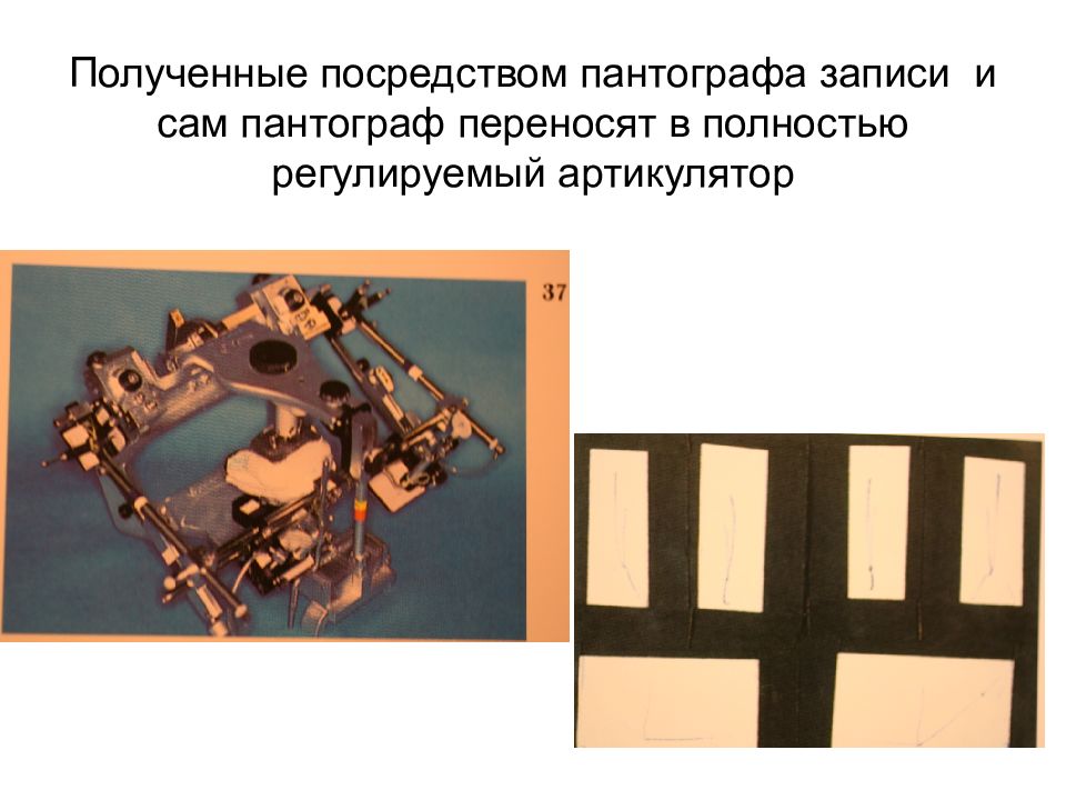 Получено посредством. Пантограф для нижней челюсти движения. Благодаря пантографу движутся.