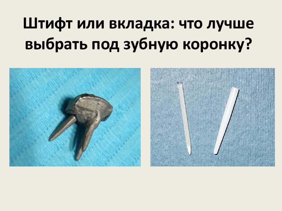 Штифт или вкладка: что лучше выбрать под зубную коронку?