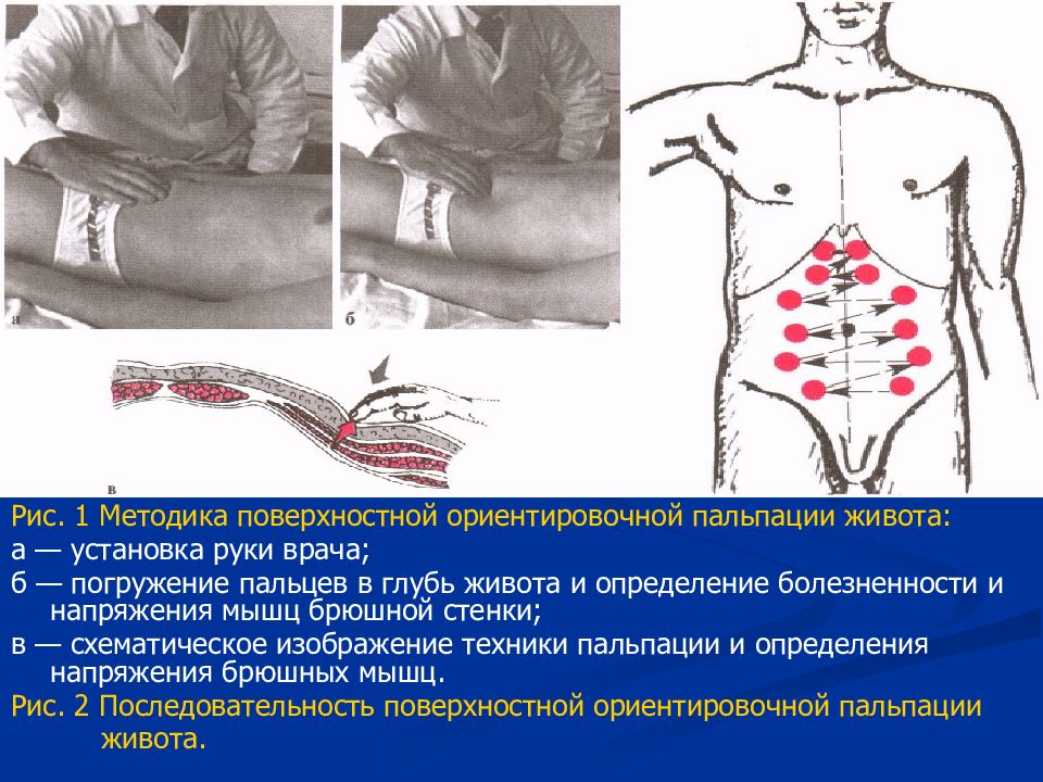 4 нарисовать топографическое расположение отделов толстого кишечника при глубокой пальпации живота