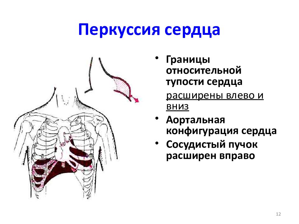 Сердцев лево. Перкуссия относительной сердечной тупости. Перкуссия границ относительной тупости сердца норма. Топографическая перкуссия сердца границы. Пропедевтика границы относительной тупости сердца.