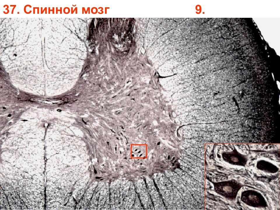 Гистология мозга. Спинной мозг гистология препарат. Спинной мозг гистология импрегнация серебром. Срез спинного мозга гистология препарат. Поперечный срез спинного мозга гистология препарат.