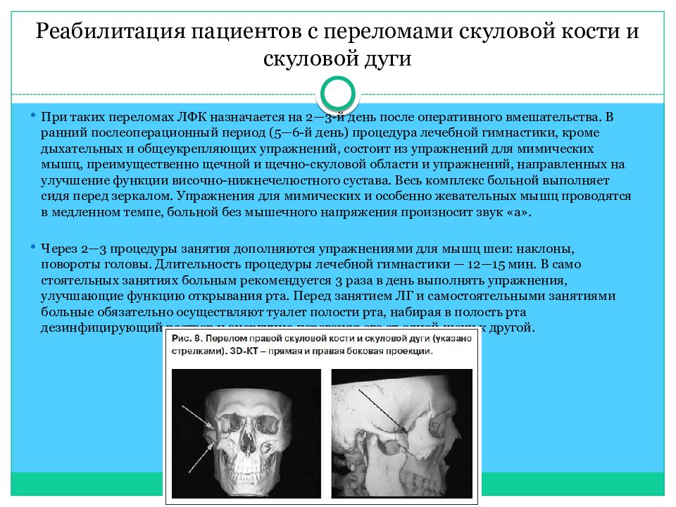 Переломы скуловой кости и дуги презентация