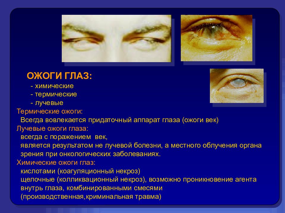 Заболевание и повреждение глаз биология 8 класс. Химические и термические ожоги, электроофтальмия. Травмы глаза презентация.