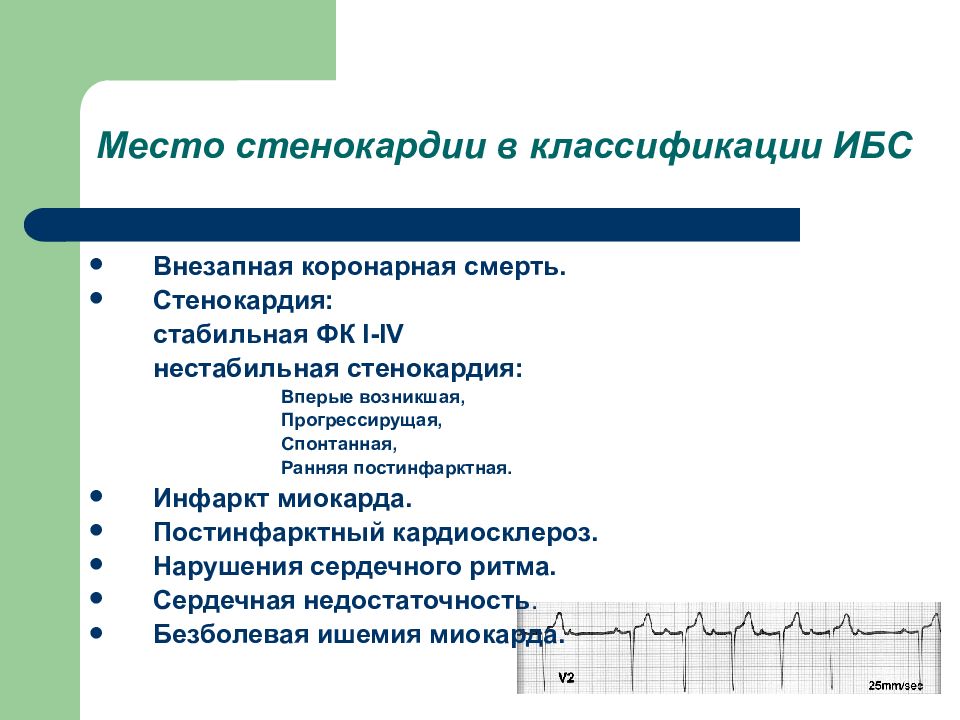 Диагноз стабильной стенокардии. Нестабильная стенокардия спонтанная. ИБС нестабильная стенокардия. Стабильная стенокардия презентация. Классификация прогрессирующей стенокардии.