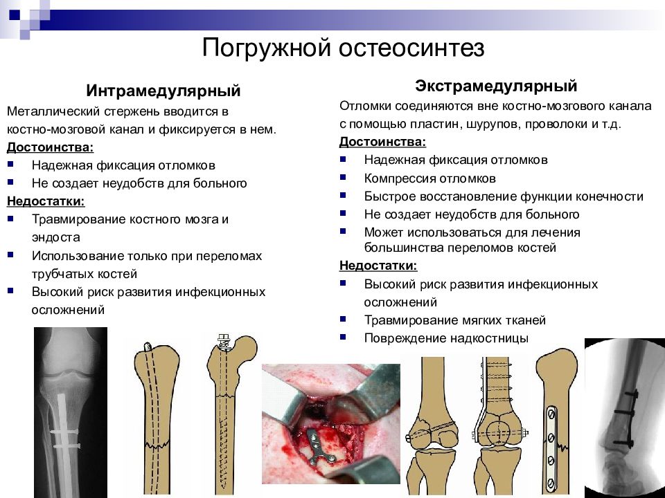 Схема колесникова травматология