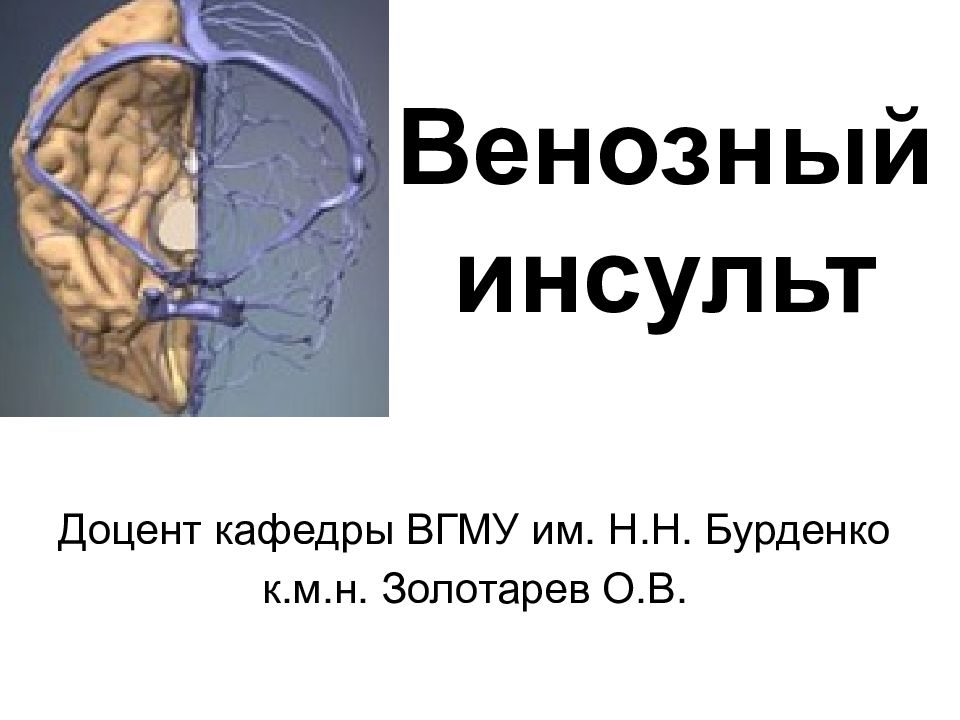 Инсульт сердца презентация