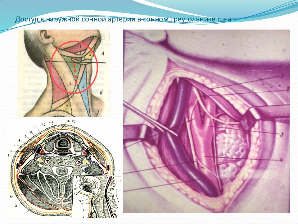Операции на шее топографическая анатомия презентация