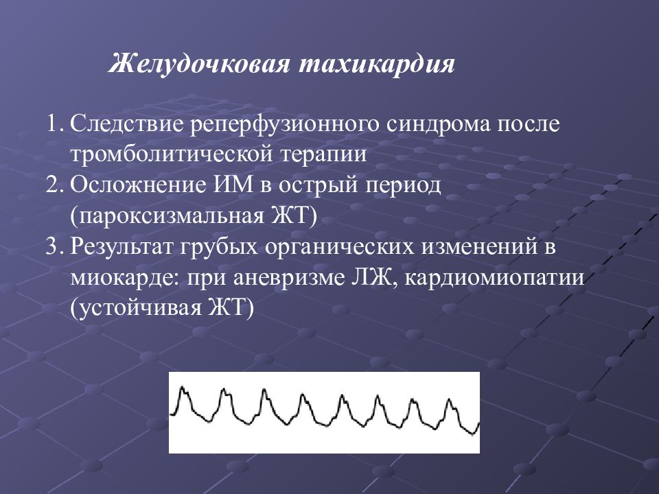 Аритмии и блокады сердца презентация