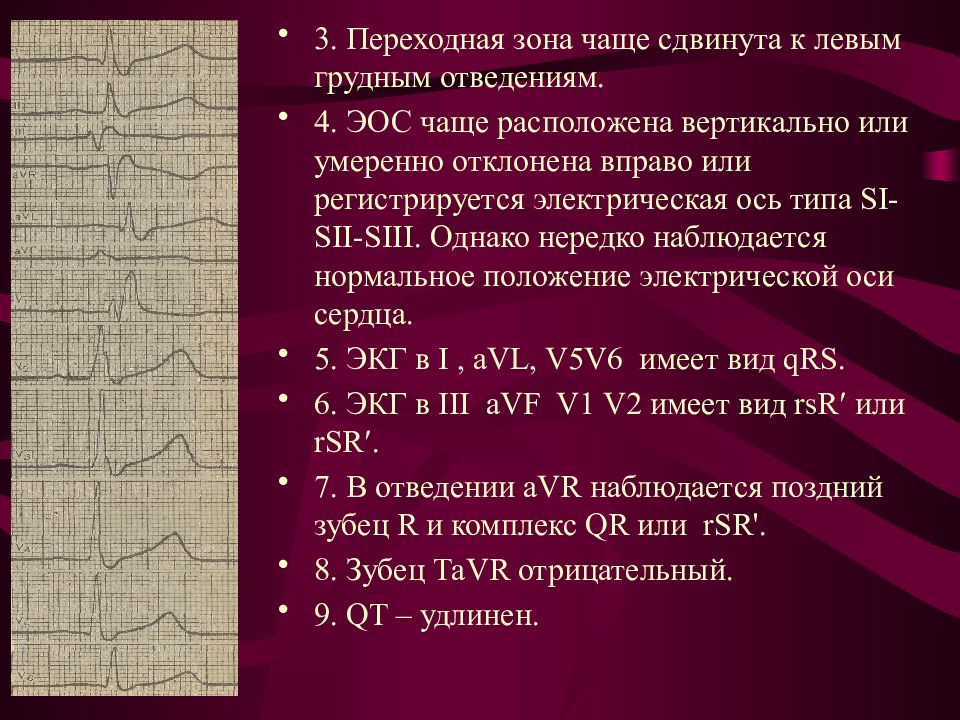 Сердце отклонено вправо. Электрическая ось s1-s2-s3 на ЭКГ. Электрическая ось сердца s1-s2-s3. Электрическая ось сердца типа s1-s2-s3 на ЭКГ. Электрическая ось типа s1-s2-s3.