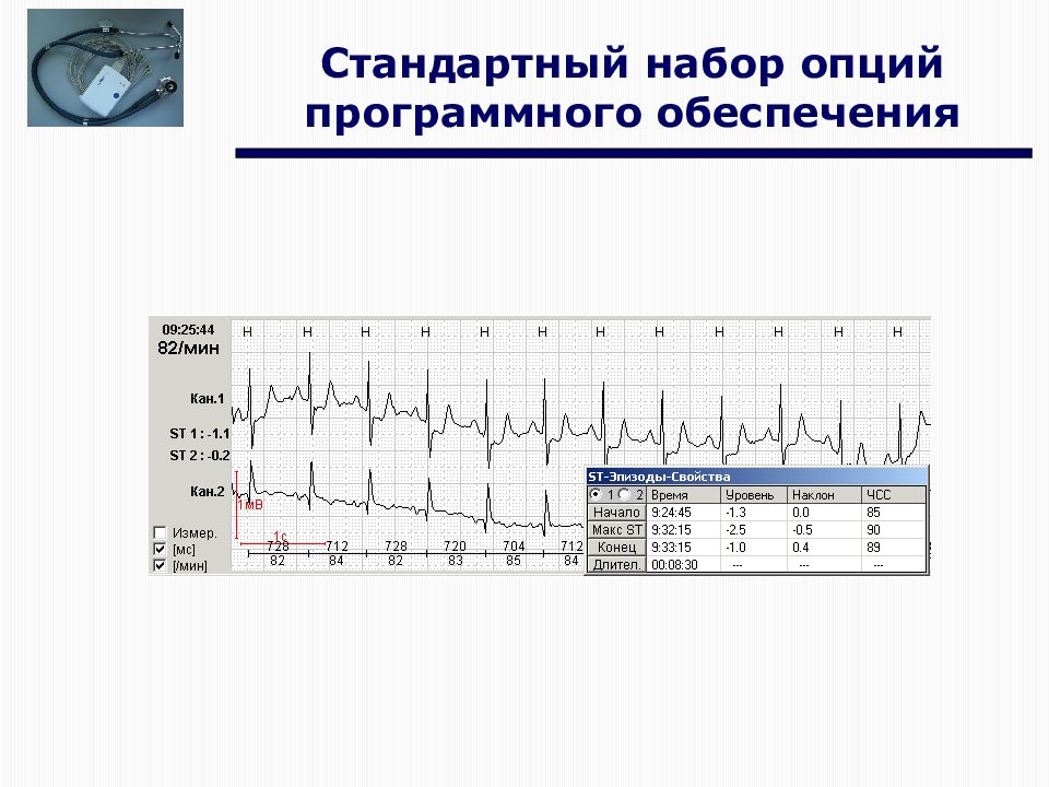 Современное экг. Современная кардиостимуляция на холтеровском мониторе ЭКГ. Первова современная кардиостимуляция на холтеровском мониторе ЭКГ. Первова современная кардиостимуляция на холтеровском мониторе. Холтеровское мониторирование ЭКГ возможности трудности ошибки.