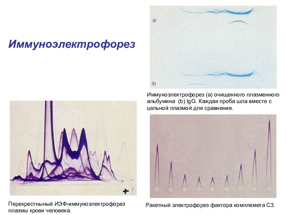 Электрофорез по разбитым зеркалом. Перекрестный иммуноэлектрофорез. Встречный иммуноэлектрофорез микробиология. Иммуноэлектрофорез иммунология. Электрофорез иммуноэлектрофорез.