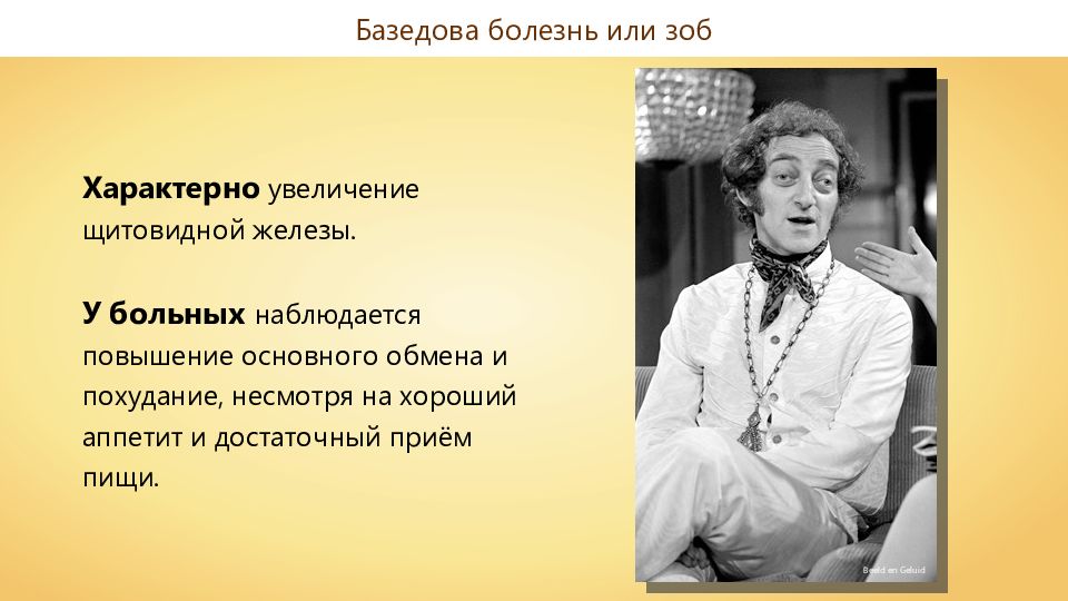 Увеличение характерный. Базедова болезнь презентация. Базедово лицо характерно для больных. Для базедовой болезни не характерно. Для базедовой болезни характерно.