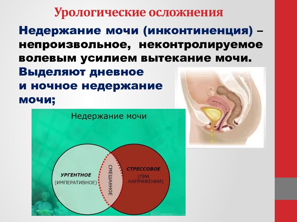 Инконтиненция. Сестринский уход при недержании мочи. Прозерин при недержании мочи.