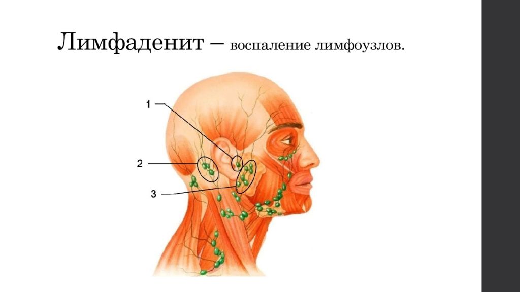 Лимфоузлы под челюстью схема