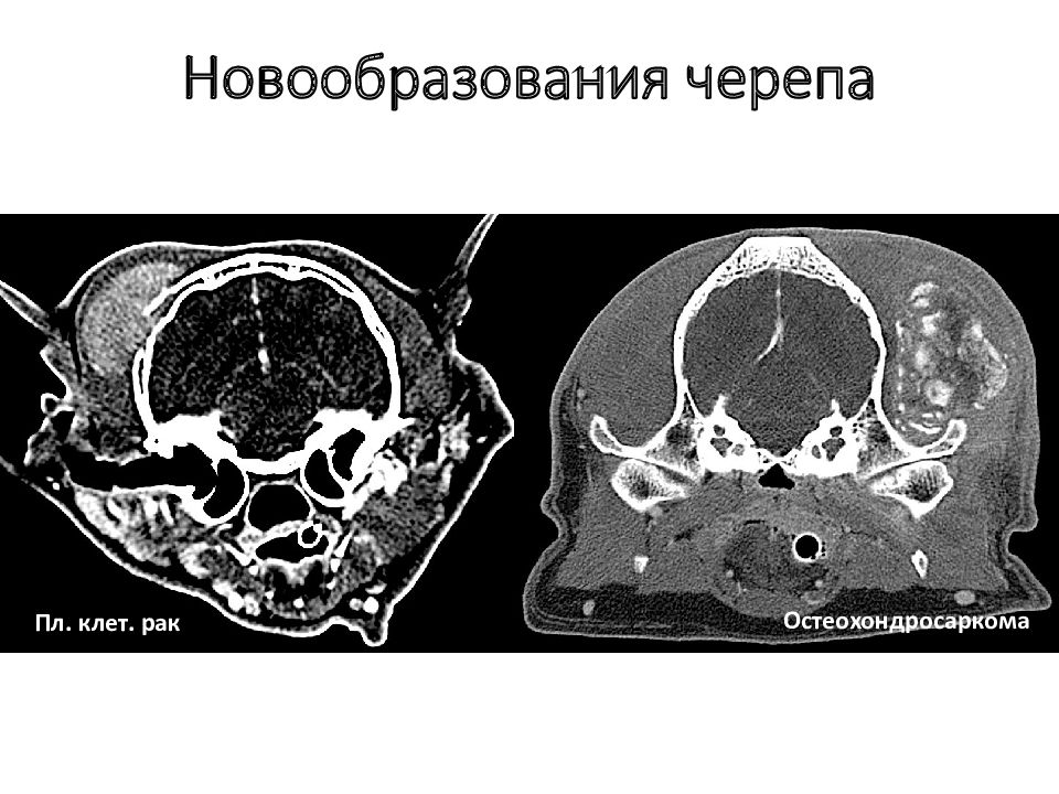 Компьютерная томография в неврологии презентация