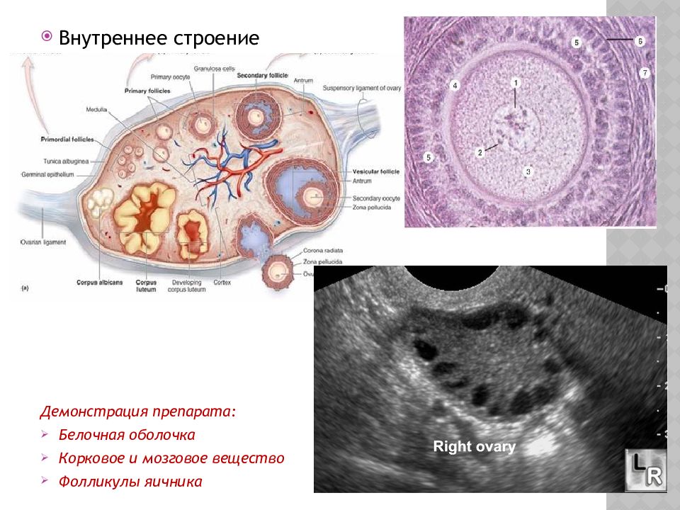 Фолликулы в яичниках что это. Внутреннее строение яичника. Строение яичника анатомия. Корковый слой яичника. Строение белочной оболочки яичника..