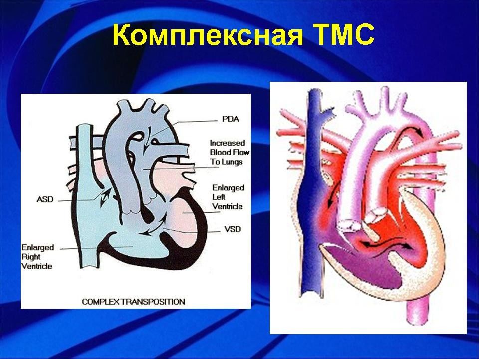 Анатомо физиологические особенности ссс презентация