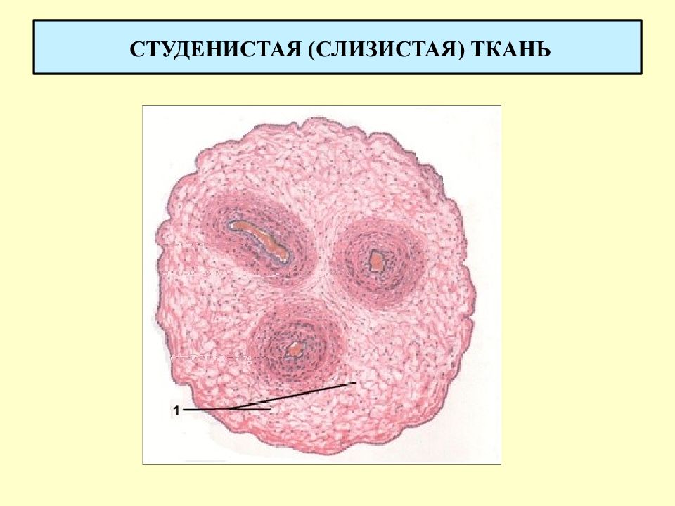 Слизистая ткань рисунок. Слизистая ткань гистология. Студенистая соединительная ткань препарат. Слизистая соединительная ткань пупочного канатика. Слизистая соединительная ткань препарат.