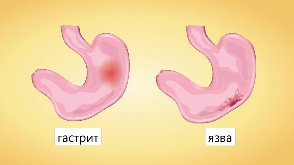 Покажи желудок. Вместимость желудка человека составляет.