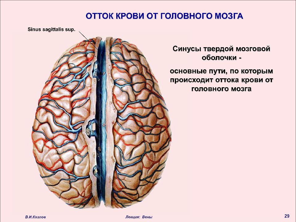 Отток крови от головного мозга. Отток крови из головного мозга. Отток венозной крови от головного мозга. Венозный отток от головного мозга.