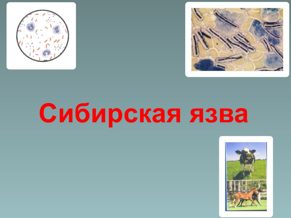 Сибирская язва