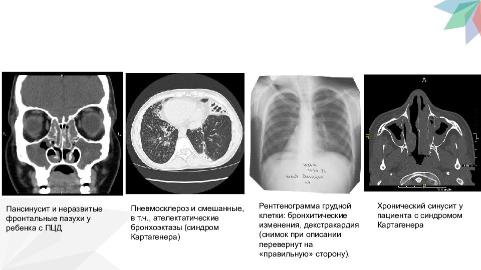 Презентация клинический случай педиатрия