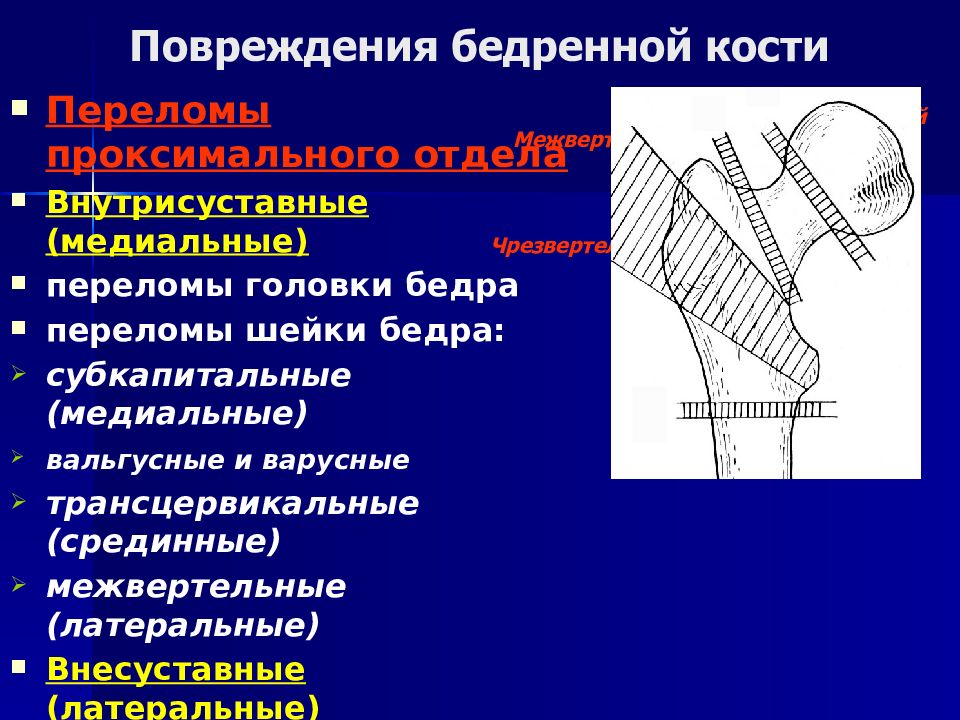 Переломы проксимального отдела бедренной кости презентация