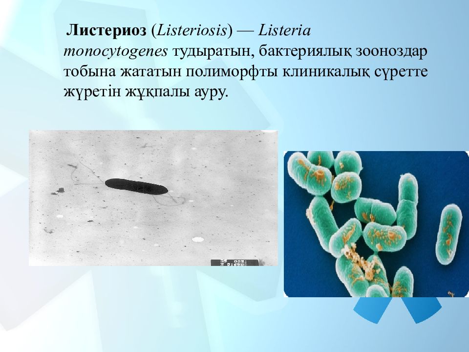 Листериоз иммунитет. Возбудитель листериоза.