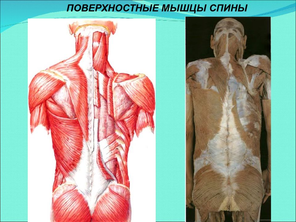 Поверхностные мышцы спины. Мышцы спины. Мышцы спины поверхностный слой. Поверхностные мышцы спины анатомия.