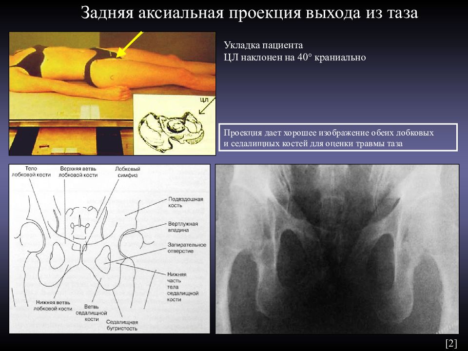 Укладки в рентгенологии в картинках и с описанием