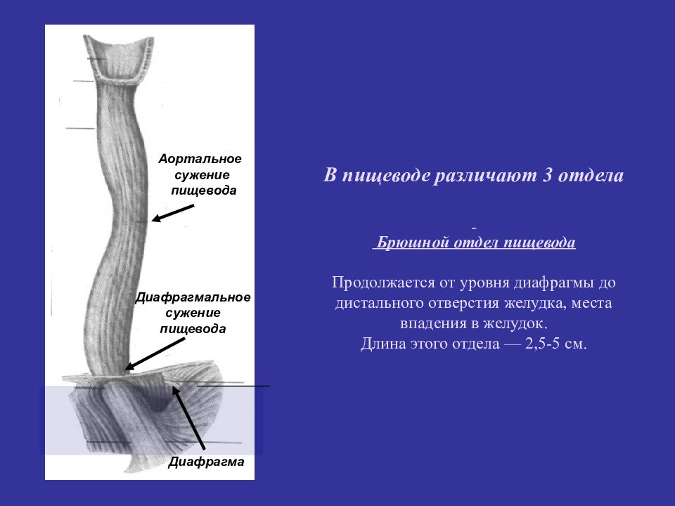 Сужения пищевода схема