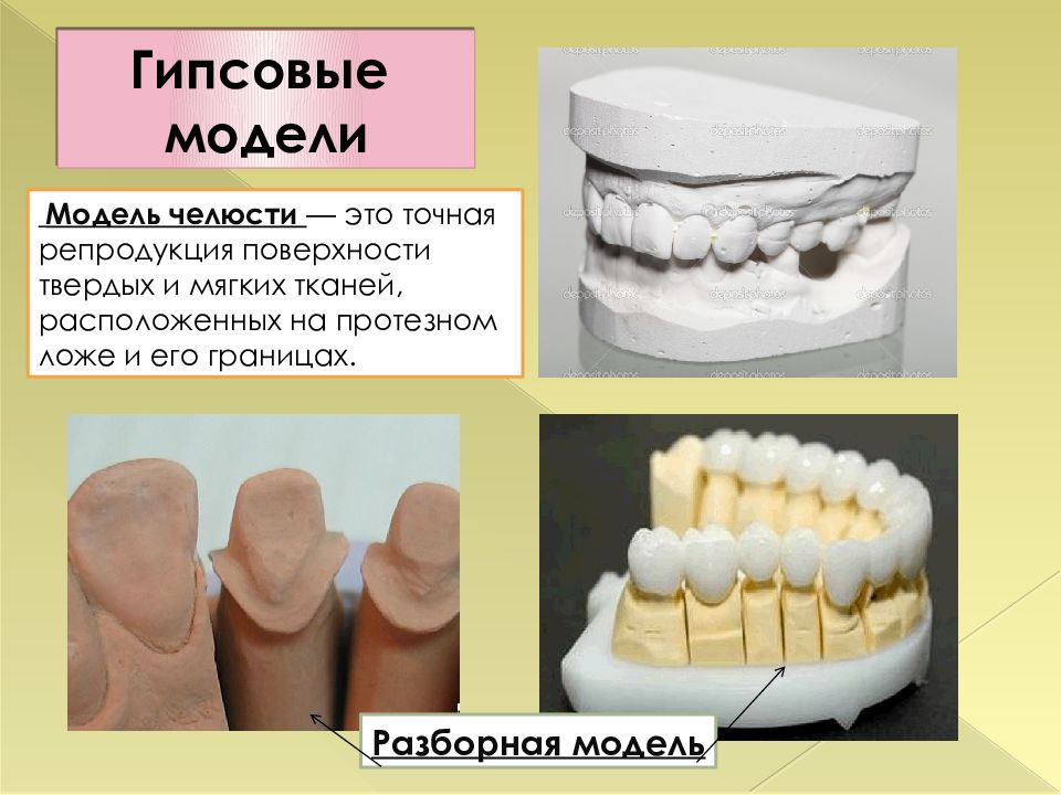 Вкладки ортопедическая стоматология презентация