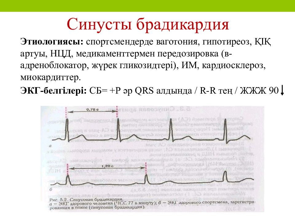 Карта вызова скорой медицинской помощи синусовая брадикардия