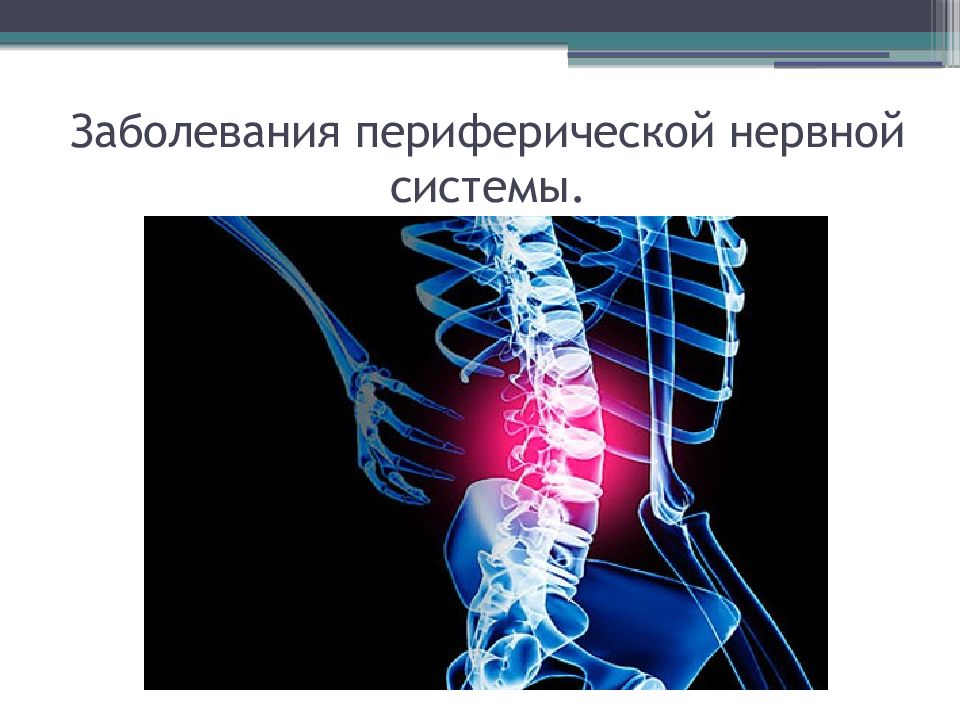 Заболевания периферической нервной. Классификация поражения периферической нервной системы. Поражение периферической нервной системы. Вертеброгенные заболевания периферической нервной системы. Болезни периферических нервов.