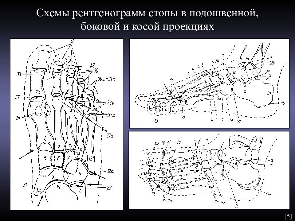 Проекции рентгенограмм. Кости стопы рентгеноанатомия. Рентгеноанатомия костей стопы. Рентгеноанатомия плюсневых костей. Рентгеноанатомия таранной кости.