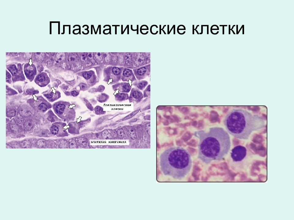плазматические клетки соединительной ткани. плазматические клетки гистология функции. плазматические клетки под микроскопом. плазматические клетки гистология функции. функции плазматических клеток в соединительной ткани.