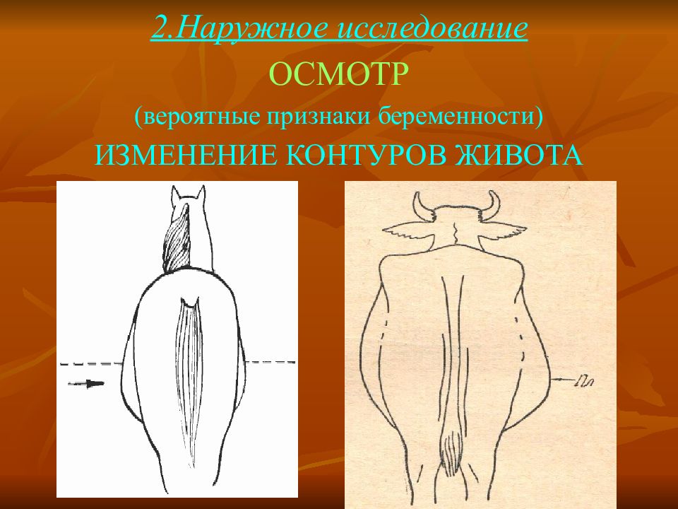 Наружное исследование