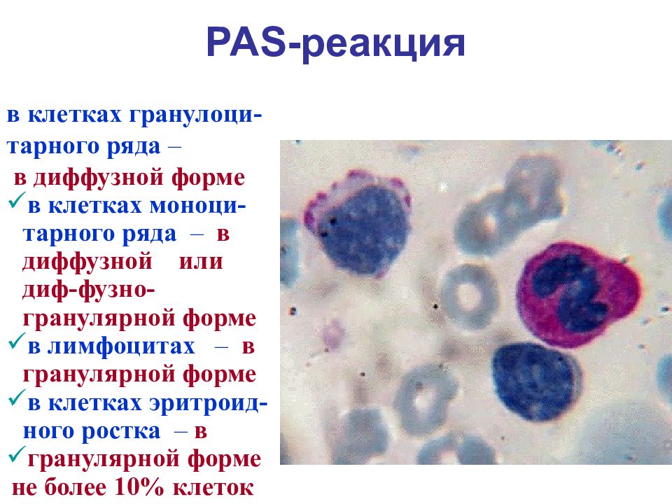 Презентация по лейкозам