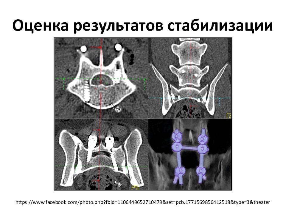 Компьютерная томография в неврологии презентация