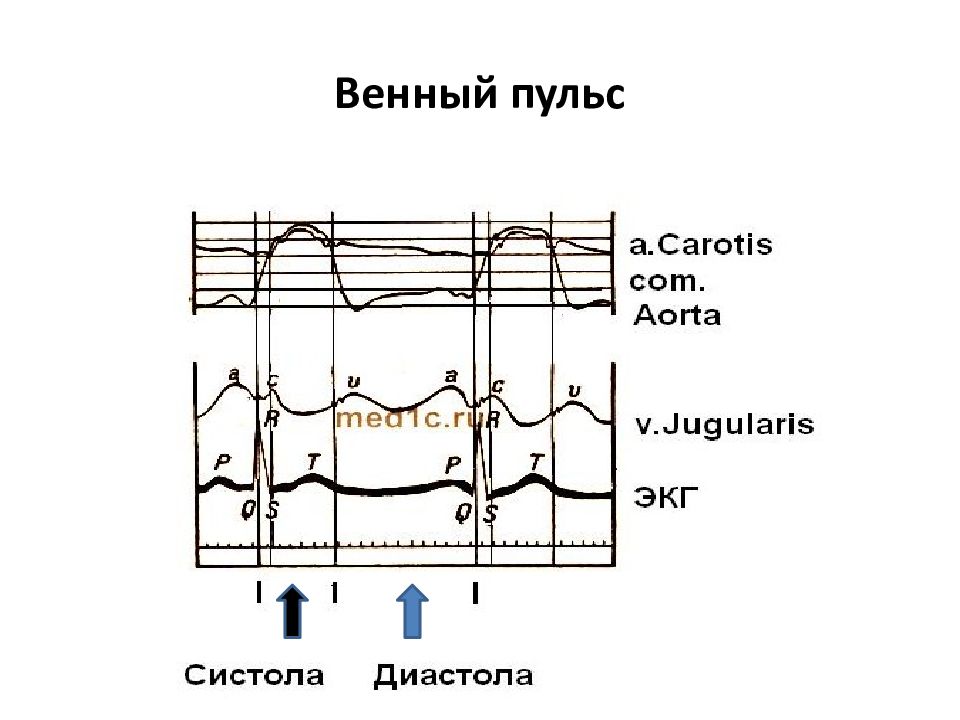 Отрицательный венный пульс