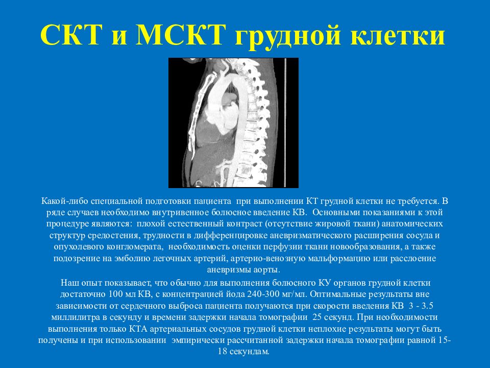 Скт это. Спиральная компьютерная томография органов грудной полости. Алгоритм компьютерной томографии грудной клетки. Спиральная компьютерная томограмма.