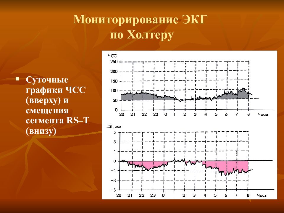 Пример чсс. Суточное мониторирование ЭКГ график. Холтеровское мониторирование ЧСС. Диаграмма суточного мониторирования. ЧСС на Холтере.