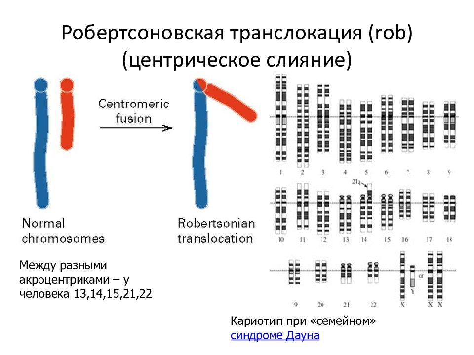 14 хромосома. Робертсоновская транслокация между 14 и 21 хромосомами. Робертсоновские транслокации. Робертсоновская транслокация 13 хромосомы на 15. Робертсоновская транслокация 13 и 14.