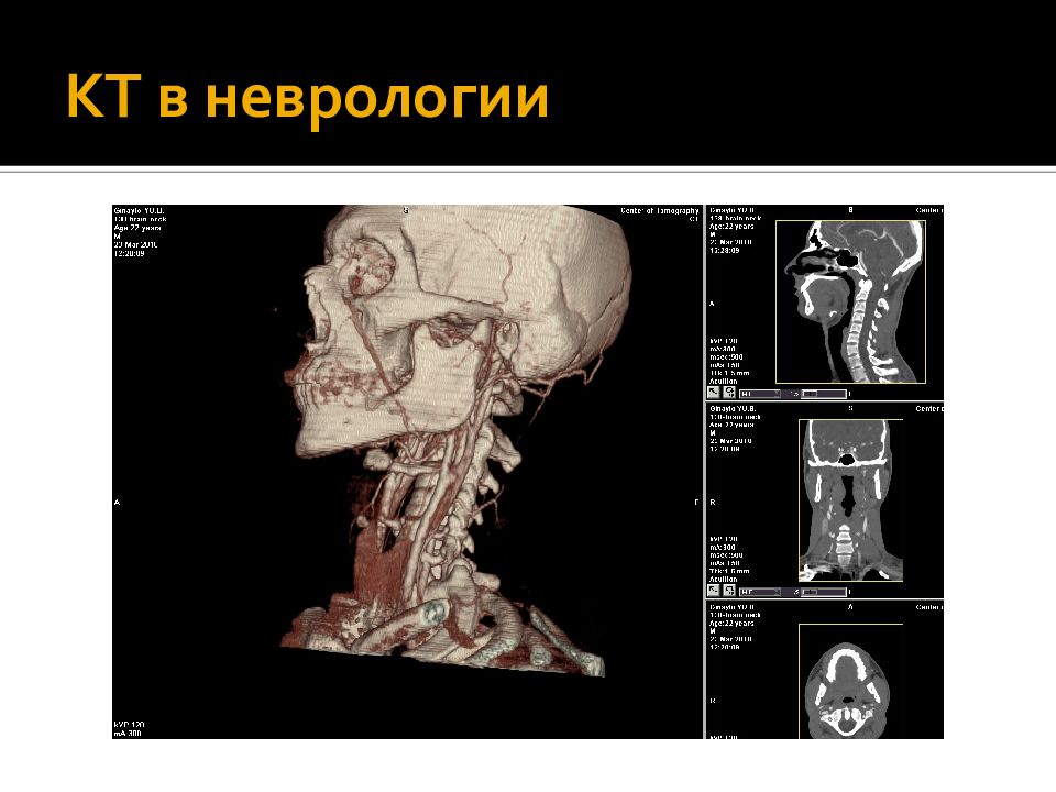 Презентация на тему компьютерная томография