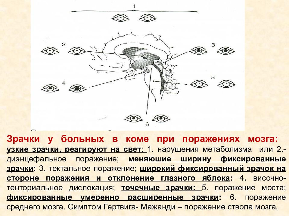 Что же такое свет. Не реагируют на свет. Выключатель прикол. Не реагируют на свет. Вялая реакция зрачков на свет.